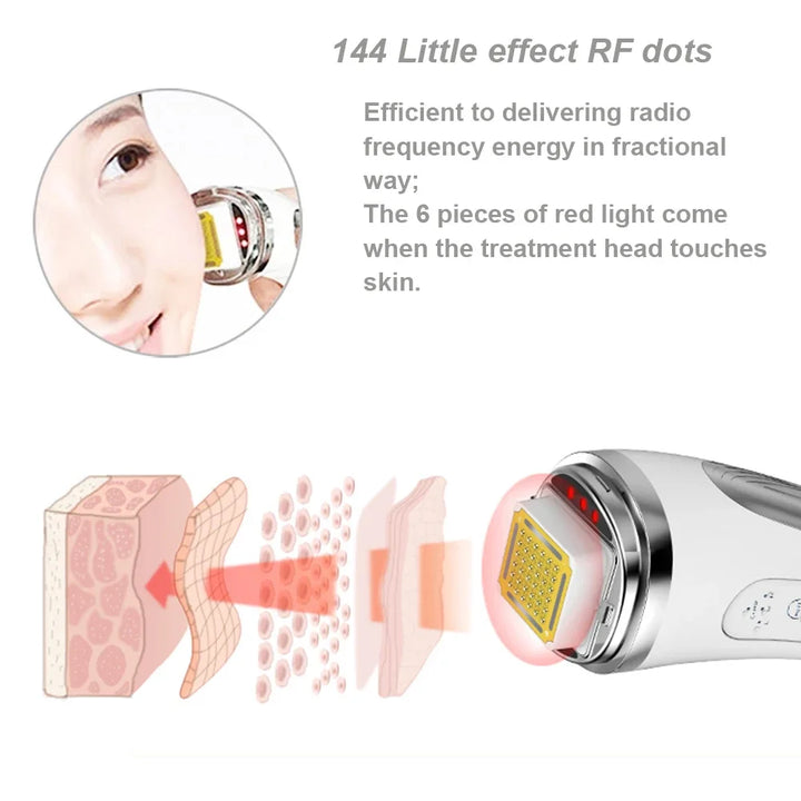 Radio Frequency Facial Lifting Machine Dot Matrix Wrinkle Removal SKin Tightening RF High Frequency Facial Care Massager Device