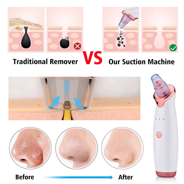 Blackhead Remover Diamond Dermabrasion Nose Vacuum Pore Cleanser Acne Pimple Suction Extractor USB Rechargeable Skin Care Tool