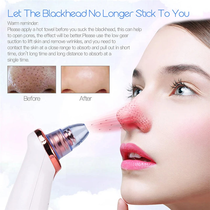 Blackhead Remover Diamond Dermabrasion Nose Vacuum Pore Cleanser Acne Pimple Suction Extractor USB Rechargeable Skin Care Tool